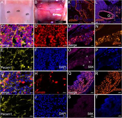 Multiple congenital malformations arise from somatic mosaicism for constitutively active Pik3ca signaling